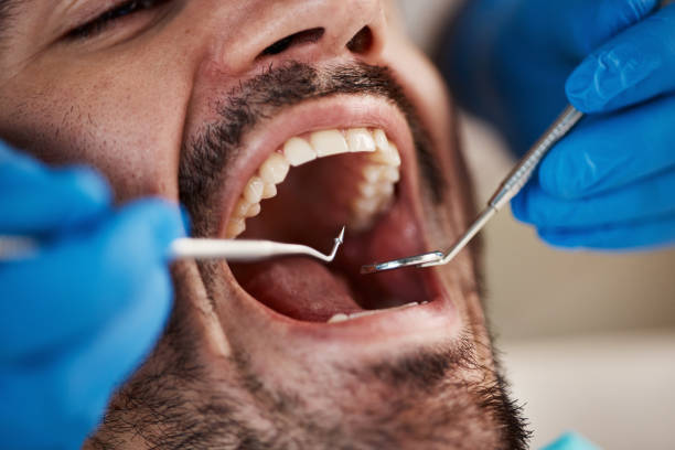 Best Emergency Dentist for Knocked-Out Tooth in Ogdensburg, NJ